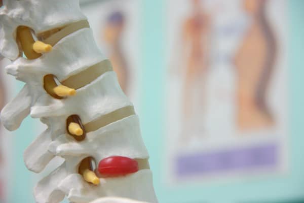spinal decompression main synergy health centre victoria bc